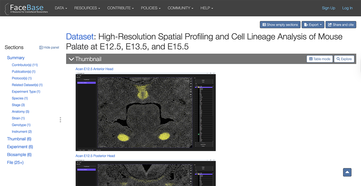 screenshot showing the Images section of a record page.